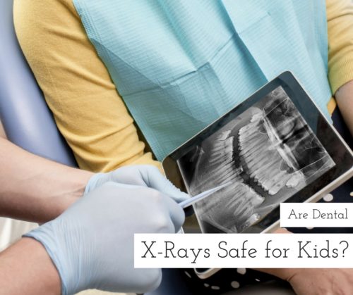 Are dental x-rays safe for kids?
