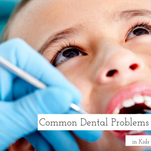 Common Dental Problems in Kids